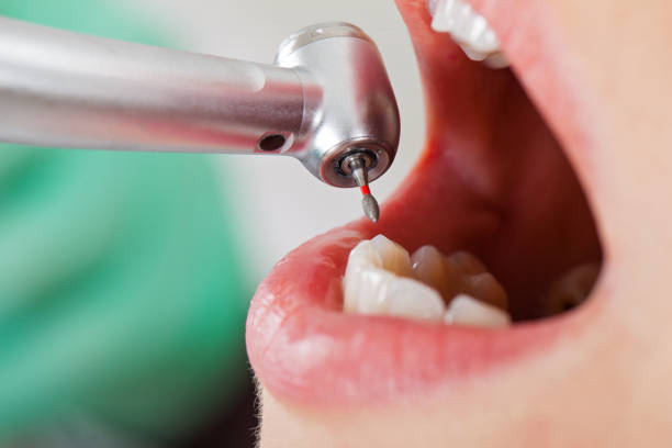 Best Emergency Denture Repair in Beebe, AR